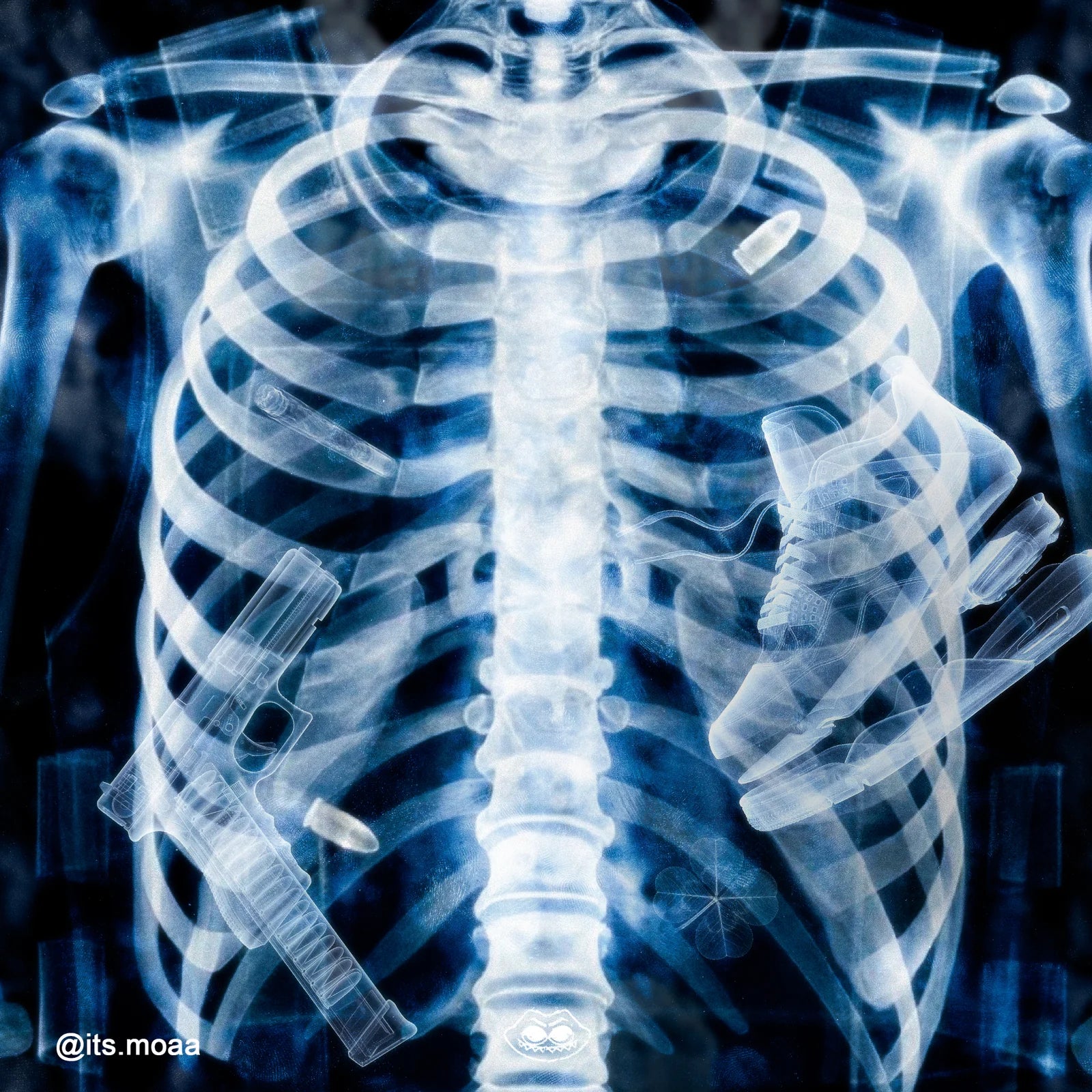 xray